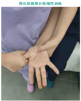 乌兰察布蒙中康复医院：大拇指疼痛难忍，你必须了解的大拇指腱鞘炎