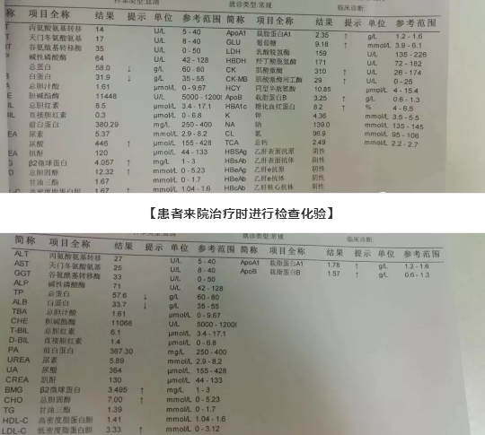 乌兰察布蒙中康复医院：（医案）三氧大自血疗法治疗“高血脂”