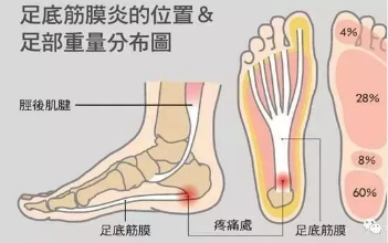 哈尔滨益德中医馆：什么是腰背肌筋膜炎?