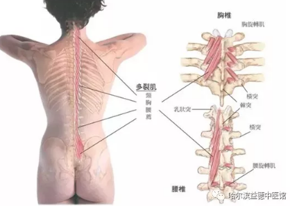 哈尔滨益德中医馆：腰椎间盘突出≠腰椎间盘突出症