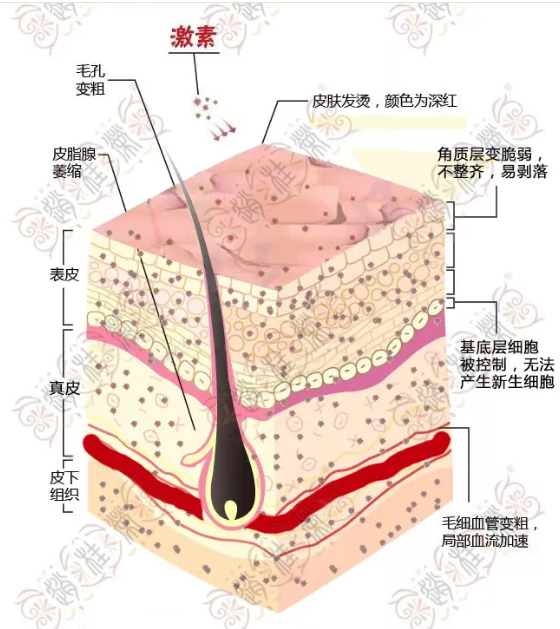 牡丹江赵桂荣中医：受益匪浅的激素脸治疗习惯，强烈建议大家养成！