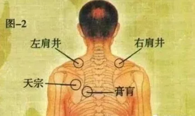 绥化市中医医院：颈肩问题，久治不断根，是这里“寒气”没有化解