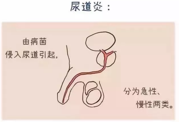 白城市新博爱医院：男“炎”之隐没法说，还是预防一下吧~