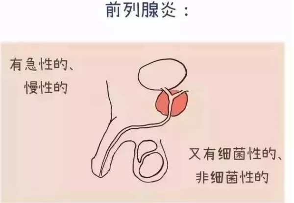 白城市新博爱医院：男“炎”之隐没法说，还是预防一下吧~