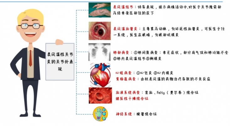 吉林市中医院：您了解类风湿性关节炎（RA）吗？