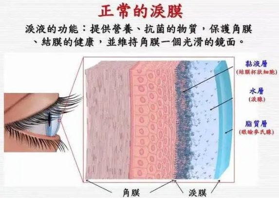 吉林市中医院：针速刺而速效,看针灸如何治疗干眼症