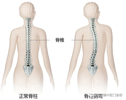 延吉仁德中医：脊椎不好，百病缠身!