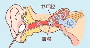 北京国医堂：儿童急性中耳炎的诊治与预防