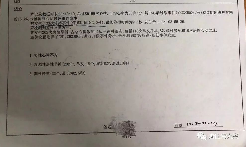 上海应象中医（医案）：沈仕伟医生治疗心律失常之窦性停搏