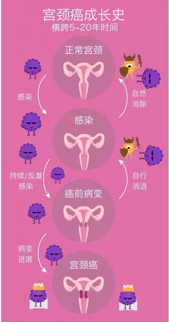 HPV是怎么感染的图片