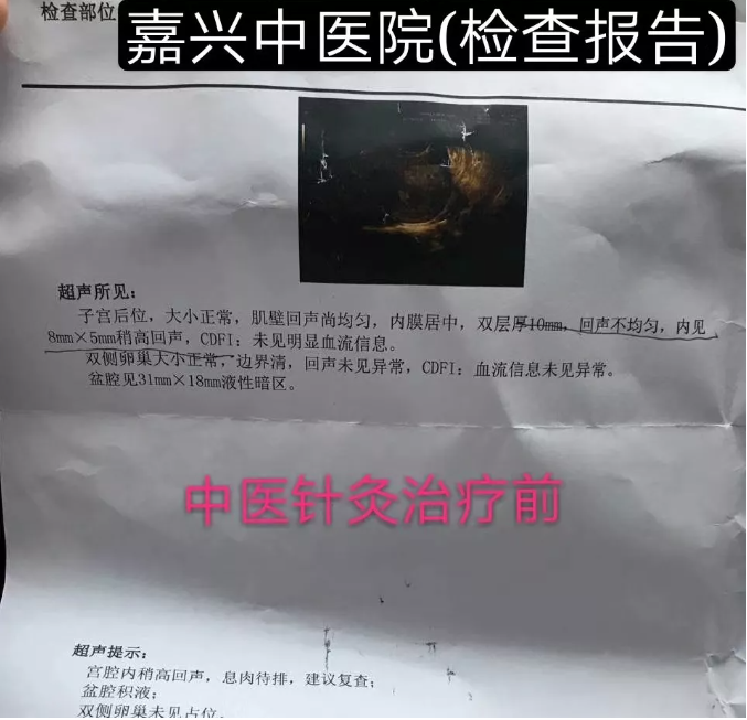 嘉兴齐福堂禾城中医馆：【国家级银针妙手—任华】子宫肌瘤中医针灸治疗案例