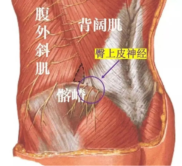 永州恒康中医医院：液针刀治疗臀上皮神经卡压