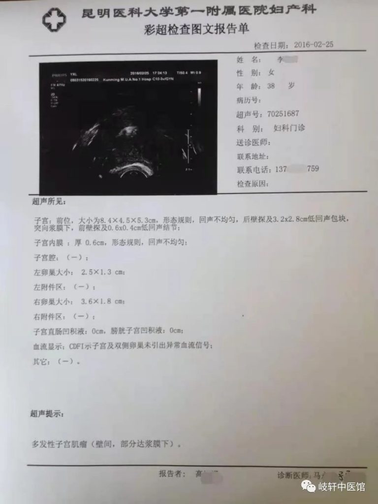 昆明岐轩中医馆：薛源清治疗子宫肌瘤