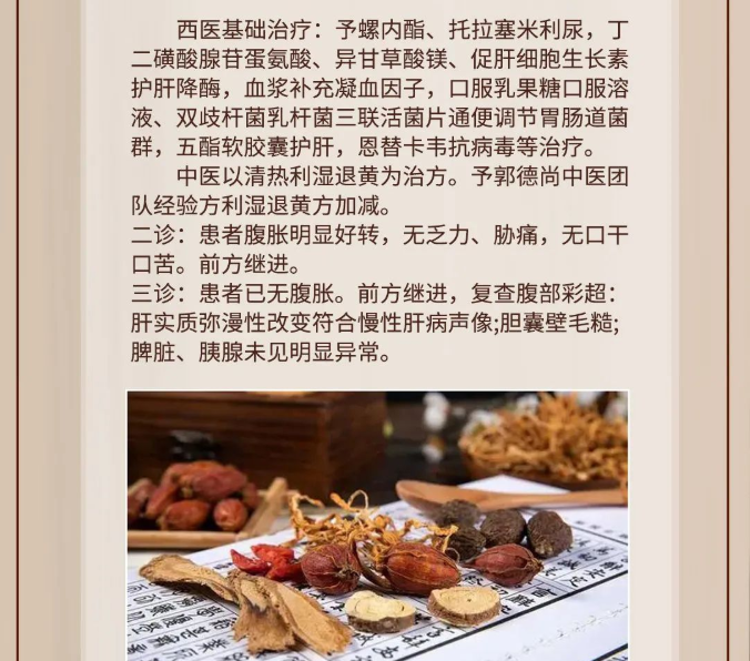 深圳维明生中医馆：肝硬化进入失代偿期腹水严重，中医辩证治疗，疗效显著