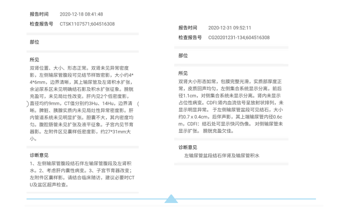 深圳申平堂中医馆：治疗肾结石医案一则