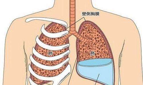 深圳维明生中医馆：肺部占位性病变导致胸腔积液，中医怎样辩证论治？