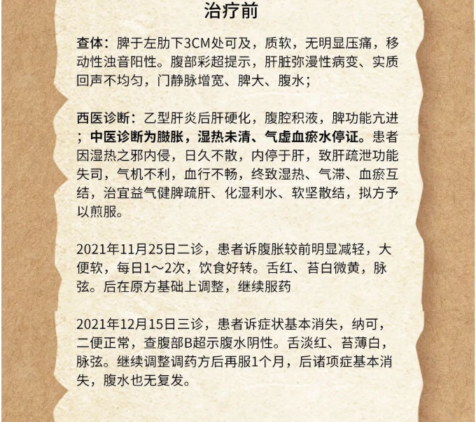 深圳维明生中医馆：肝腹水怎么治疗？肝腹水怎样防止复发？