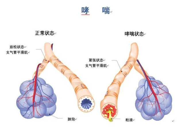 郑州管城康氏中医馆 气管炎