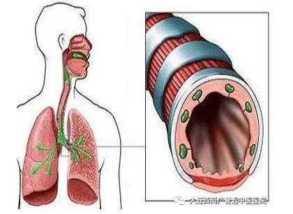 大连西岗广誉远中医医院：李娟治疗咳嗽