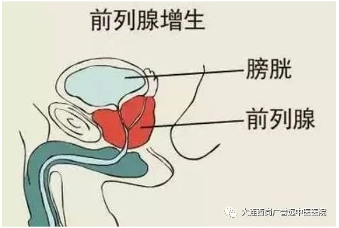 大连西岗广誉远中医医院：清宫手指点穴术治疗尿频