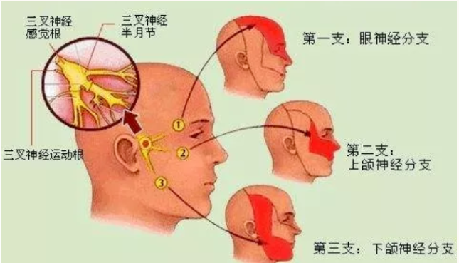 西安葆元堂中医门诊部：杨志春治疗三叉神经痛