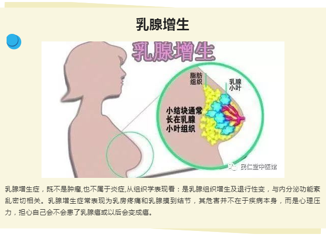 成都成华民仁堂中医诊所：何廷智治疗乳腺增生