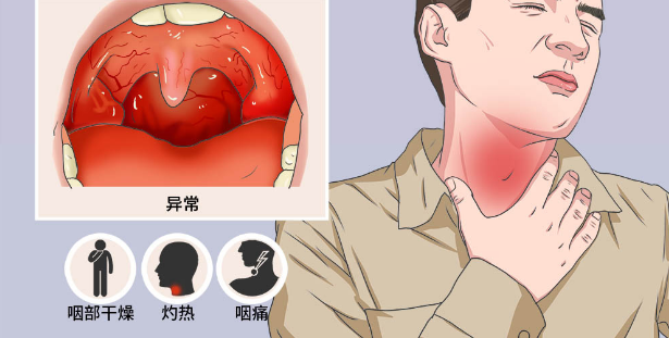 呼和浩特妙峰弘医中医医院：萨仁治疗慢性咽炎