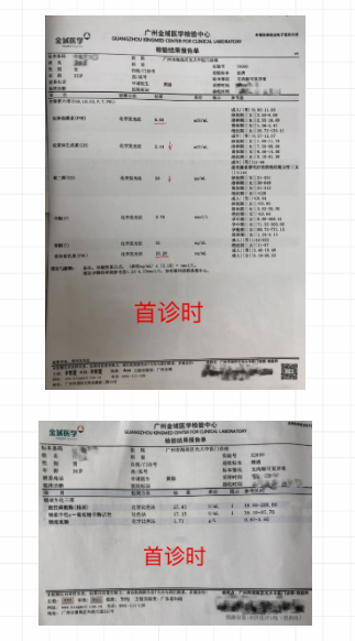 广州光大医疗门诊部：黄励调理过度紧张引起的不孕