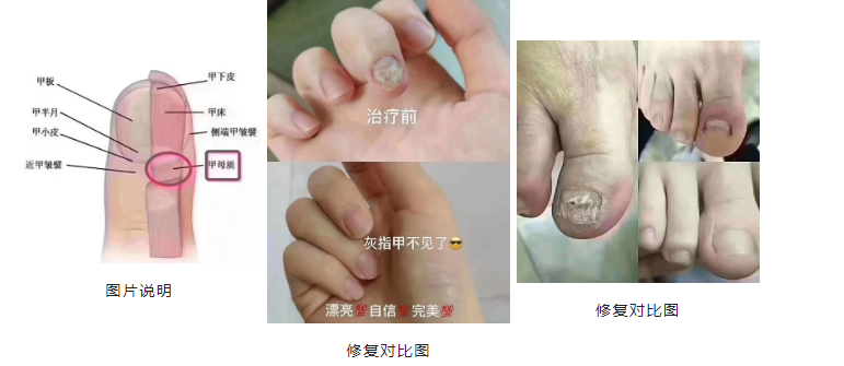 深圳泰辰中医（综合）诊所：湿气引发的足部疾病