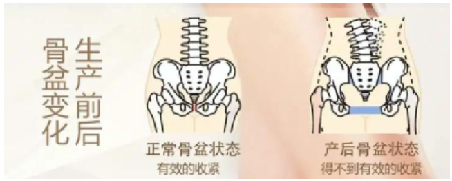 深圳康和堂中医诊：蔡达霖复位手法加针灸调理骨盆错位