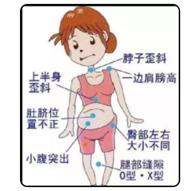 深圳康和堂中医诊：蔡达霖复位手法加针灸调理骨盆错位