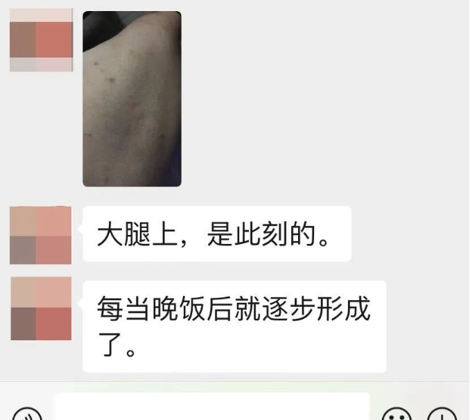 深圳朴一堂太素中医诊所：贾智渊调理荨麻疹