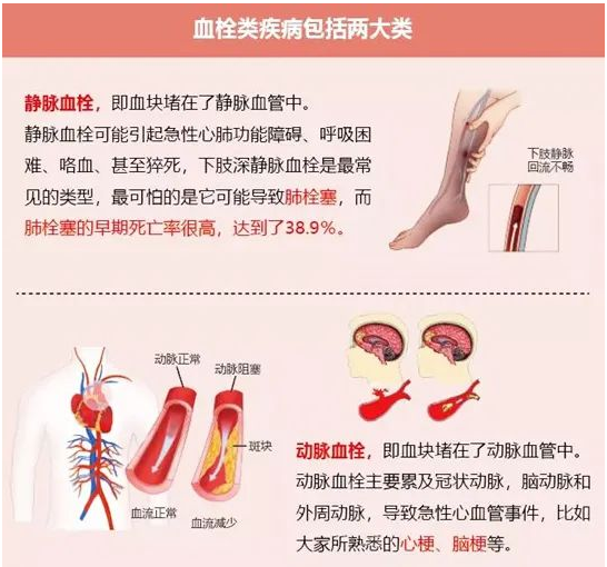 深圳鹤和中医诊所：人因何而“血栓”？你不得不知的常识