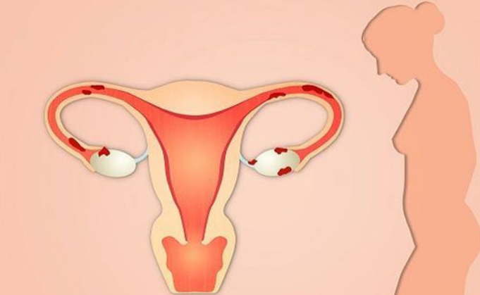 邢台太行中医医院：输卵管不通的病因及调理方法