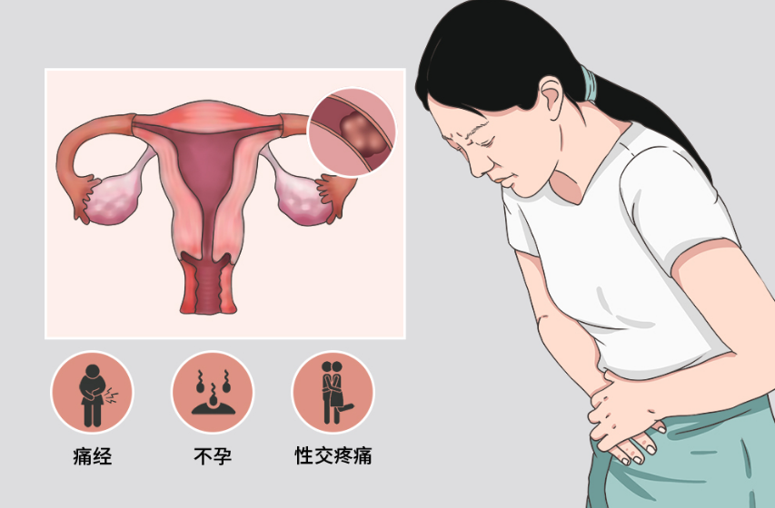 郑州美信中医院：王广宇治愈不孕不育