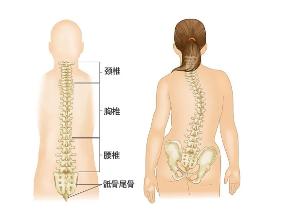 深圳正曲脊柱中医诊所：你的孩子脊柱侧弯吗？