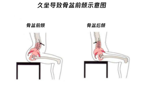 深圳正曲脊柱中医诊所：骨盆修复，并不是女生的专属！