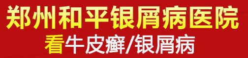 郑州二七和平中医院：儿童牛皮癣发病的原因和护理方法