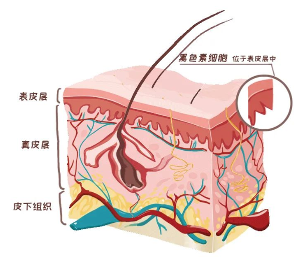 武汉环亚中医白癜风医院：白癜风原来不传染，预防它，做到这几点很重要！