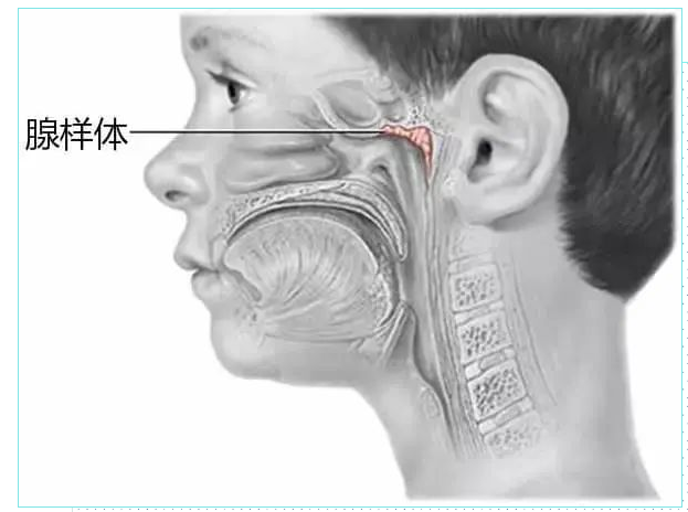 武汉源盛堂中医门诊部:儿童腺样体肥大的中医治疗