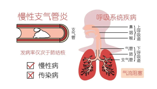 武汉健珍堂中医门诊部：神脊能量穴位埋线治疗支气管炎（附医案）