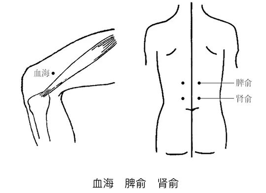 武汉健珍堂中医门诊部：为什么女性特别容易贫血？千万别再忽视它