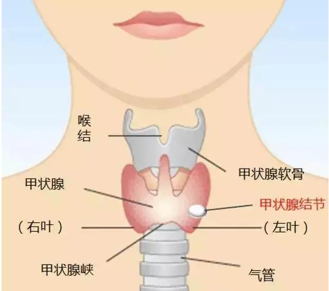 武汉和气执中中医诊所：被你忽略的桥本甲状腺炎