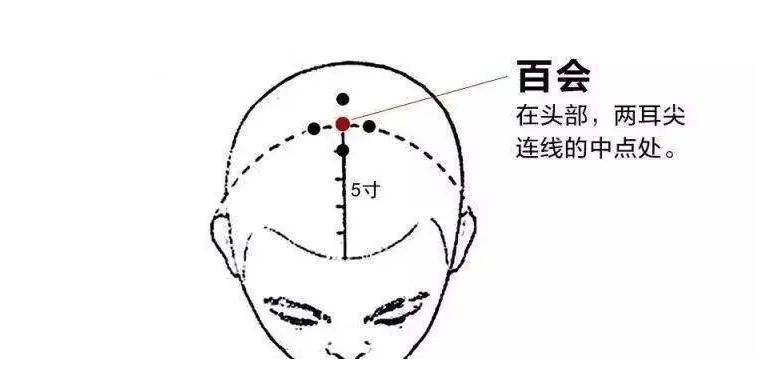 郑州三泰中医馆：偏头痛的朋友要多按摩这3个穴位