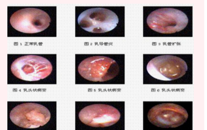 昆山聚康堂国医馆：三分钟教你看懂乳腺彩超