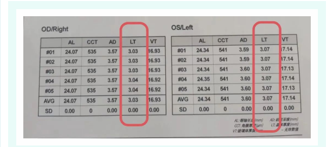 无锡梁溪太湖中医医院：近视眼为什么要做眼科光学生物测量？