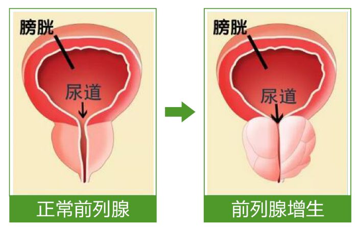 江阴百意中医医院：泌尿外科有哪些疾病?