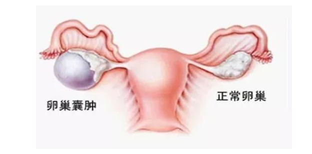 赣州宁都鸿康中医医院：“糟蹋”卵巢的行为，快看你是否中招啦！