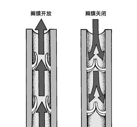 江西九江庆余堂：静脉曲张≠血管堵塞！但也不能忽视不管！