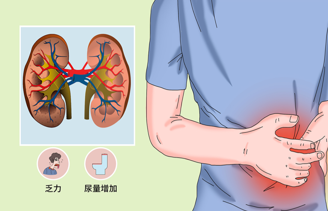 肾功能衰竭之上好方